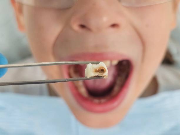 Best Walk-In Emergency Dentist in Pinckney, MI